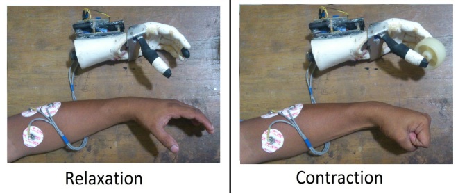Prosthetic Hand controlling using EMG signal.